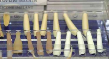 假体隆鼻的材料有哪些